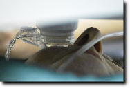 Facoemulsificazione con Impianto di IOL precaricata Zeiss CT Lucia